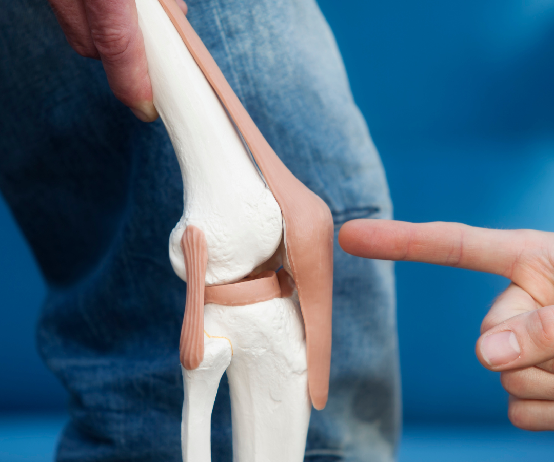 Total vs. partial knee replacement